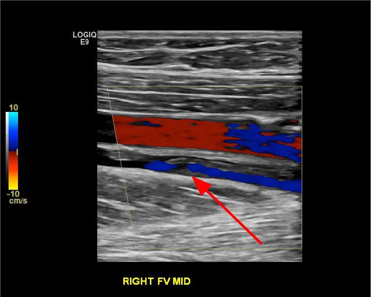 Vascular imaging example.